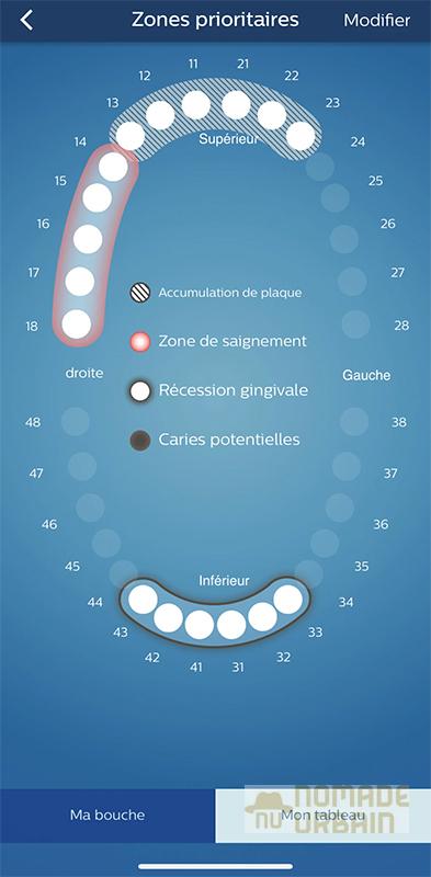 Test Philips Sonicare 9900 Prestige